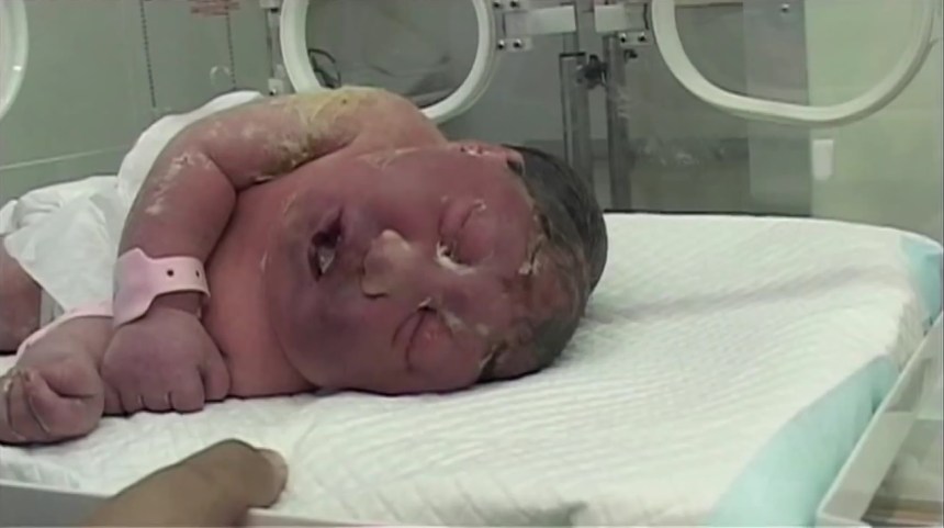 AgoraBeograd ObL44 Iraq's Deadly Legacy - ENCEPHALIA